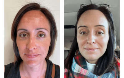 My Skincare Journey at HerSpace Med Spa in Little Silver, NJ!