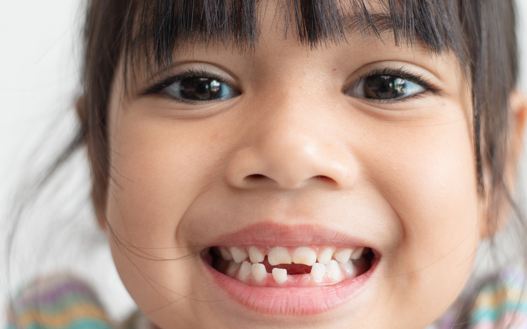 8 Reasons Why Tooth Sealants Help Prevent Cavities