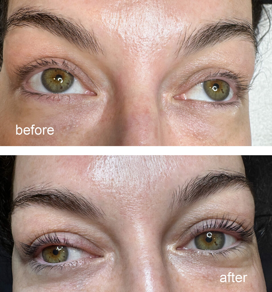 Millennium-lashes-before-after-1000px