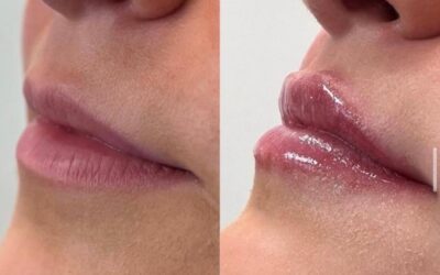 Moms of Monmouth County: Look and Feel Your Best at Reveal Image Aesthetics!