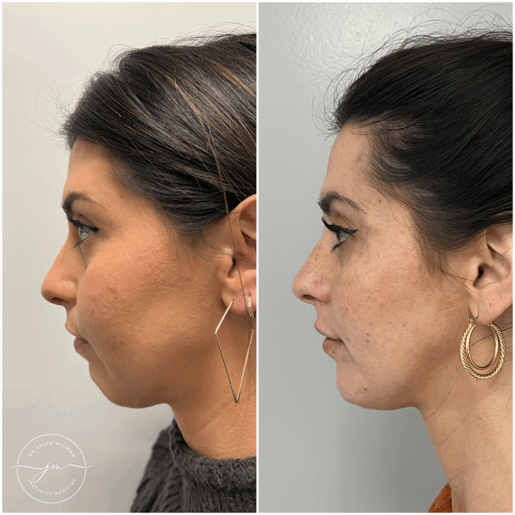 From Needles to Natural Glow: Meet Dr. Julia Milman of Aesthetic Medicine