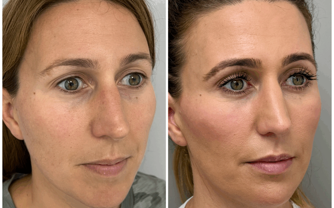 Dr. Julia Milman on Why Taking Care of Your Skin Is More Than Vanity