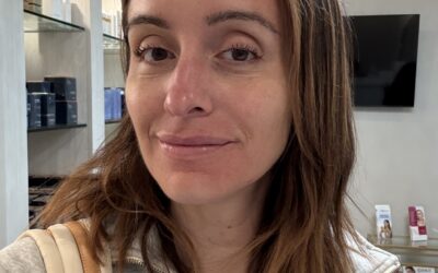My Experience with Sofwave at HerSpace Med Spa in Little Silver!
