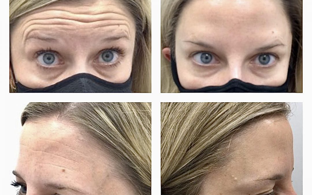 I went to the Dermatologist and…