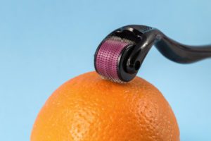 What is Microneedling?