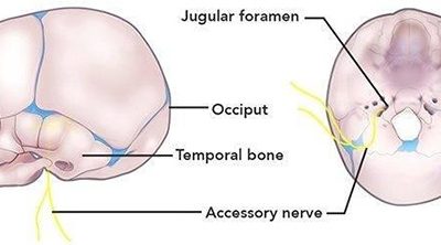 The Ultimate Guide to Plagiocephaly & Torticollis