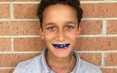 Three Different Mouth Guards Recommended by Houston Dentists