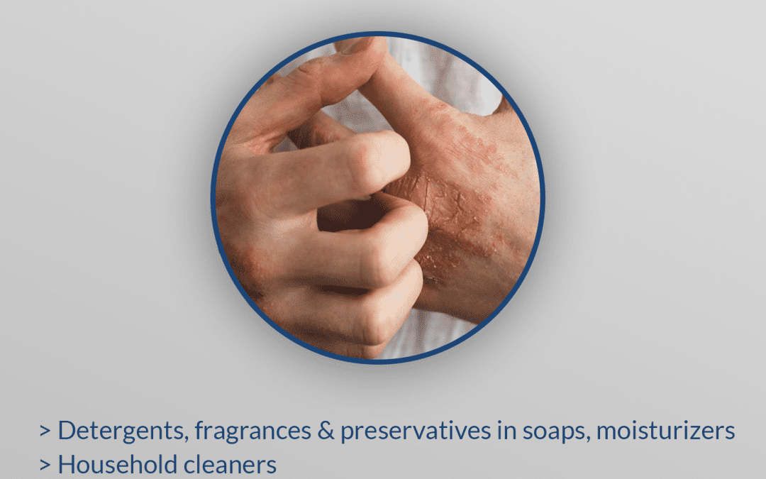Hand Washing and Hand Dermatitis Tips from Dermatology Associates